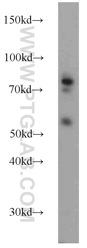 Western Blot (WB) analysis of HEK-293 cells using Kindlin 1 Polyclonal antibody (22215-1-AP)