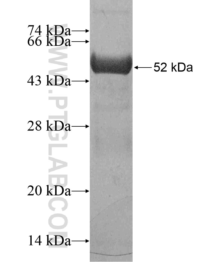 Kindlin 1 fusion protein Ag17543 SDS-PAGE