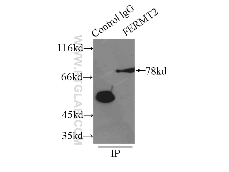 Immunoprecipitation (IP) experiment of A549 cells using Kindlin 2 Polyclonal antibody (11453-1-AP)