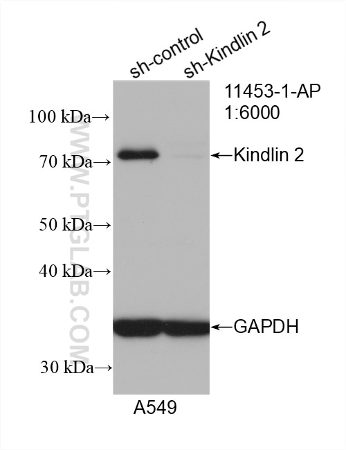 Western Blot (WB) analysis of A549 cells using Kindlin 2 Polyclonal antibody (11453-1-AP)