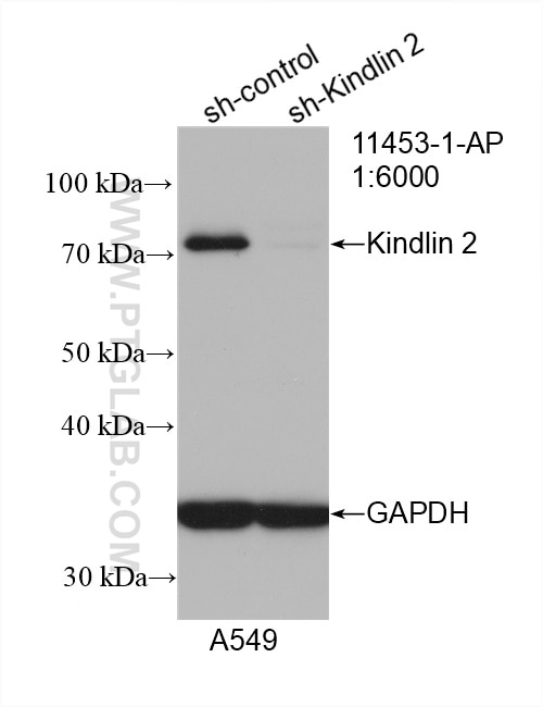 WB analysis of A549 using 11453-1-AP