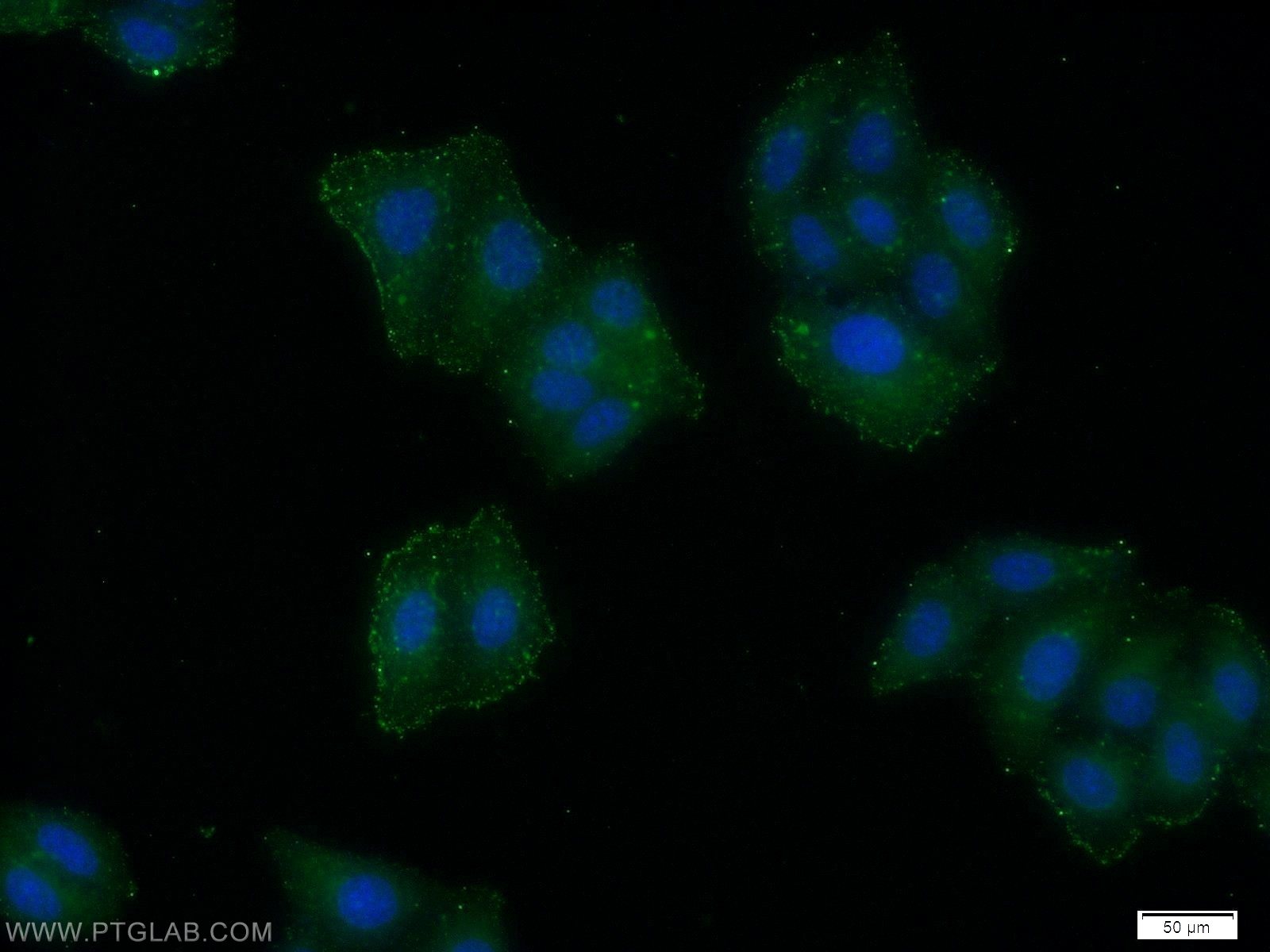 Immunofluorescence (IF) / fluorescent staining of HeLa cells using Kindlin 3 Polyclonal antibody (18131-1-AP)