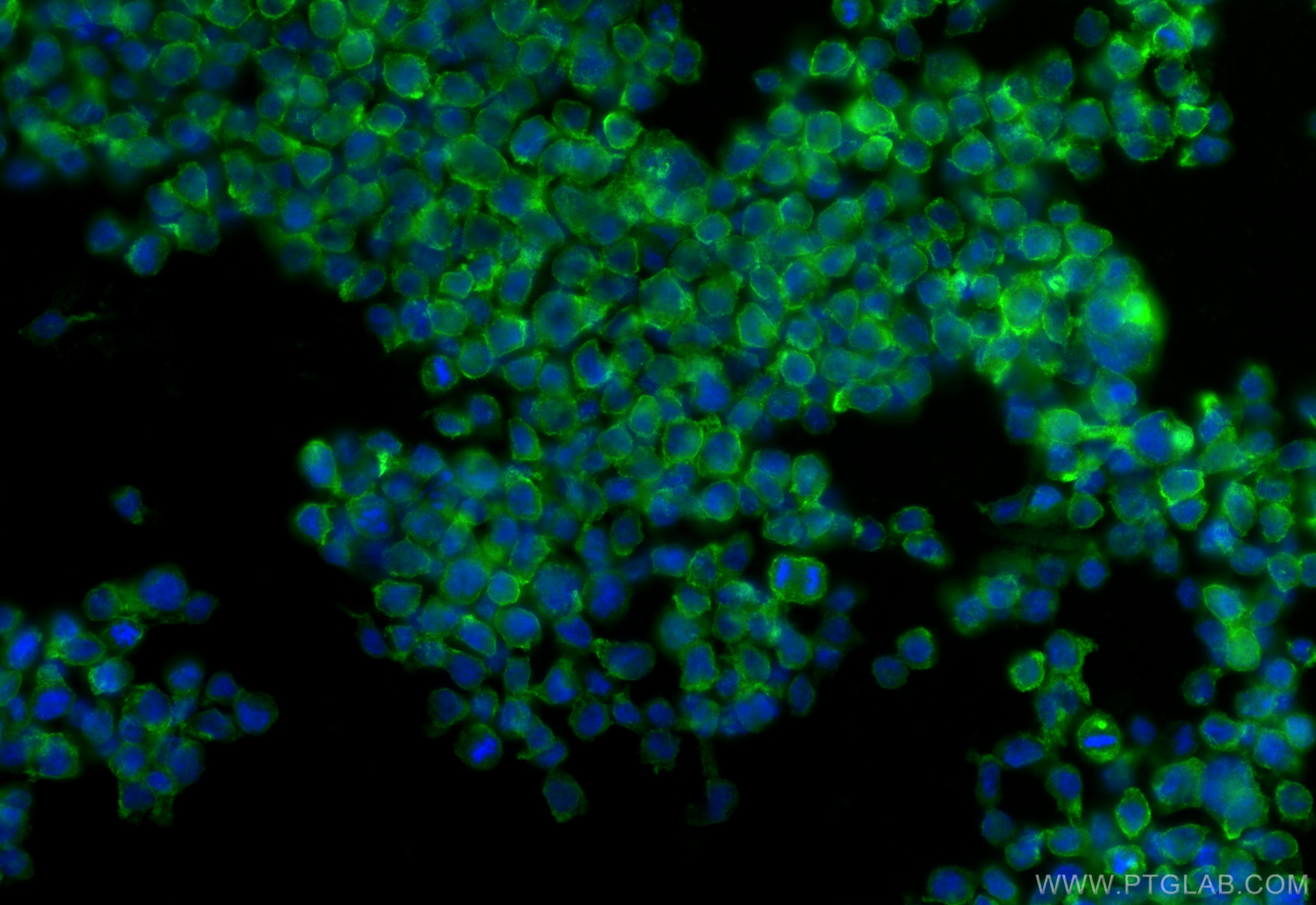 Immunofluorescence (IF) / fluorescent staining of THP-1 cells using Kindlin 3 Polyclonal antibody (18131-1-AP)