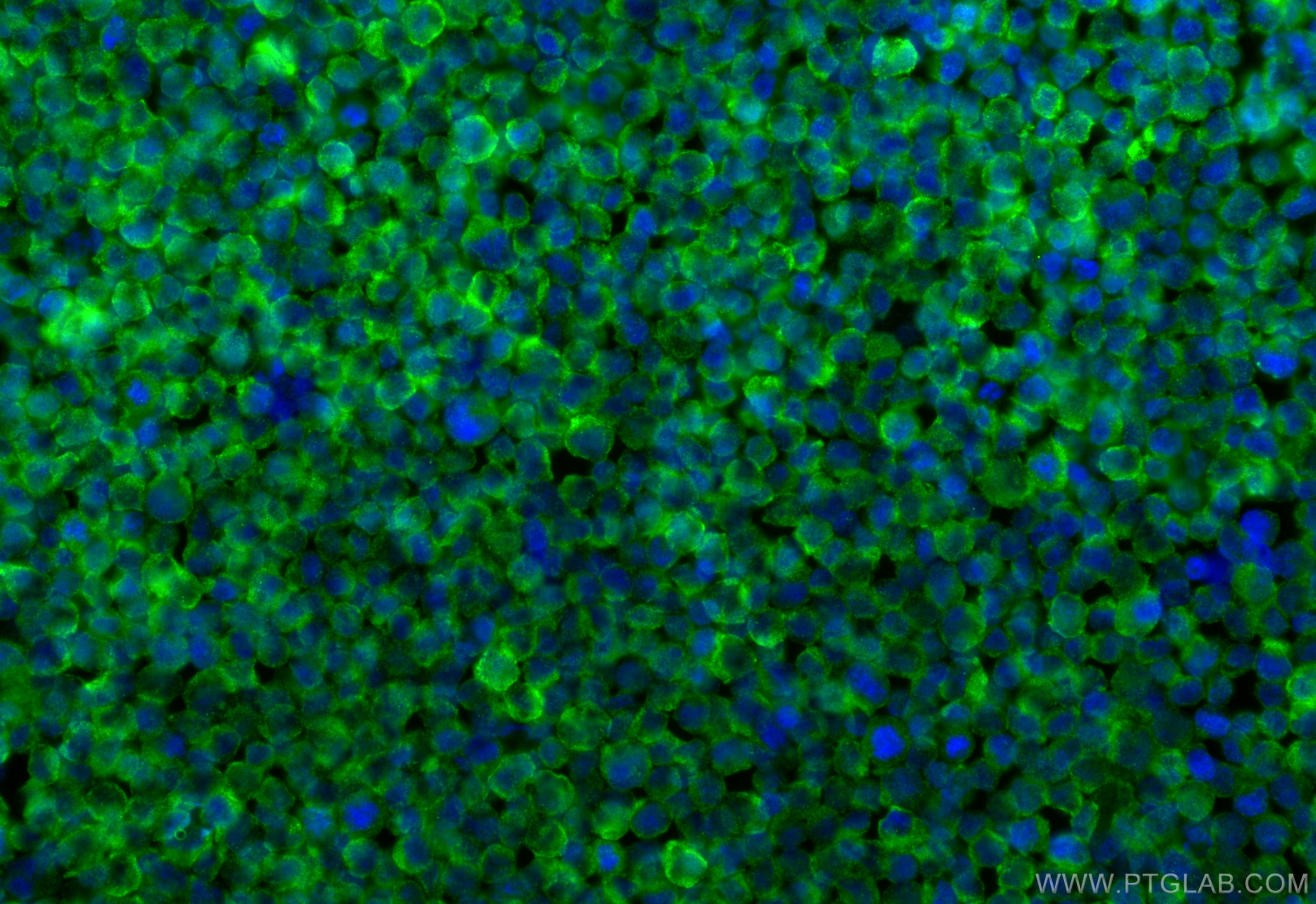Immunofluorescence (IF) / fluorescent staining of Raji cells using Kindlin 3 Polyclonal antibody (18131-1-AP)