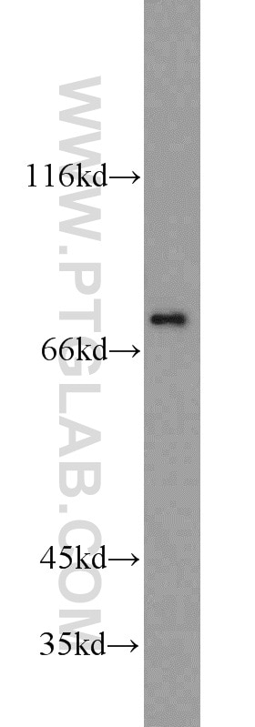 Western Blot (WB) analysis of Jurkat cells using Kindlin 3 Polyclonal antibody (18131-1-AP)