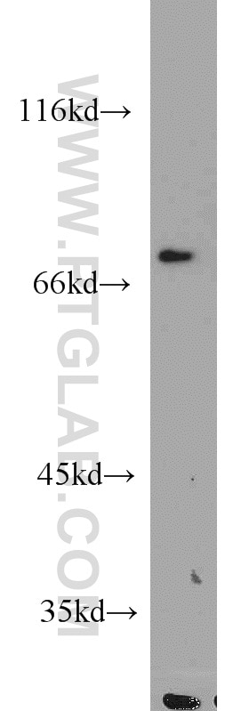 Western Blot (WB) analysis of Jurkat cells using Kindlin 3 Polyclonal antibody (18131-1-AP)