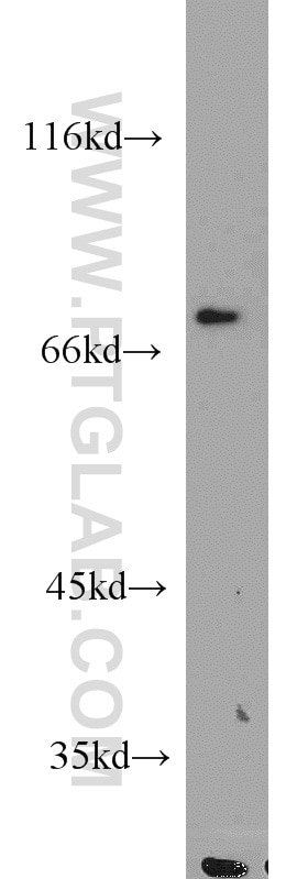 WB analysis of Jurkat using 18131-1-AP