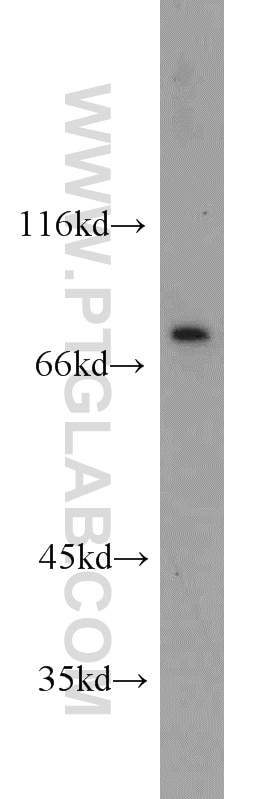 Western Blot (WB) analysis of Raji cells using Kindlin 3 Polyclonal antibody (18131-1-AP)