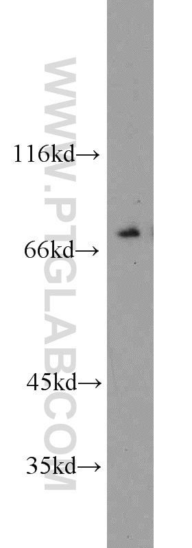 Western Blot (WB) analysis of Raji cells using Kindlin 3 Polyclonal antibody (18131-1-AP)