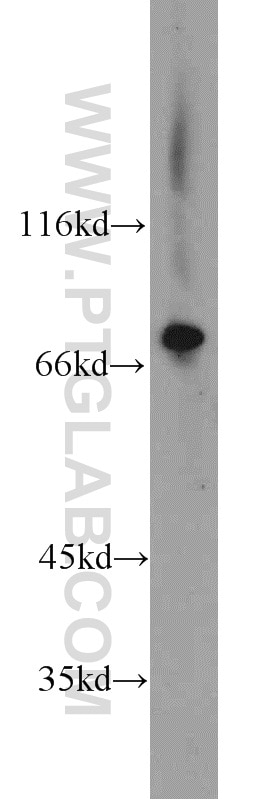 Western Blot (WB) analysis of Raji cells using Kindlin 3 Polyclonal antibody (18131-1-AP)