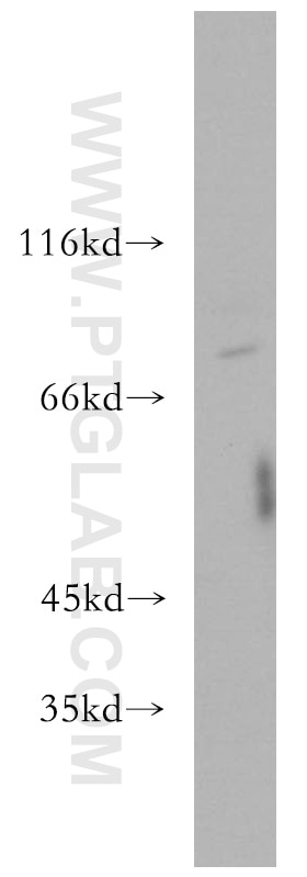 Western Blot (WB) analysis of Raji cells using Kindlin 3 Polyclonal antibody (18131-1-AP)
