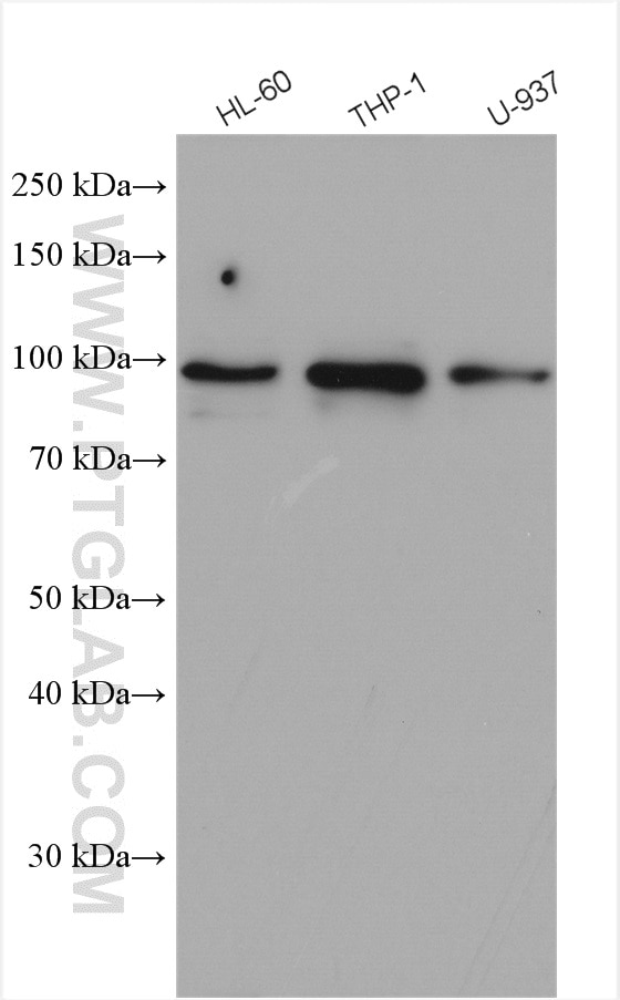 Western Blot (WB) analysis of various lysates using FES Polyclonal antibody (28194-1-AP)