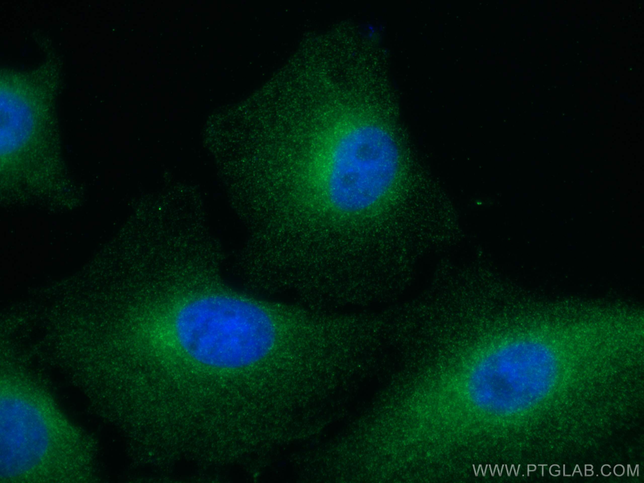 Immunofluorescence (IF) / fluorescent staining of A549 cells using FES Monoclonal antibody (67524-1-Ig)