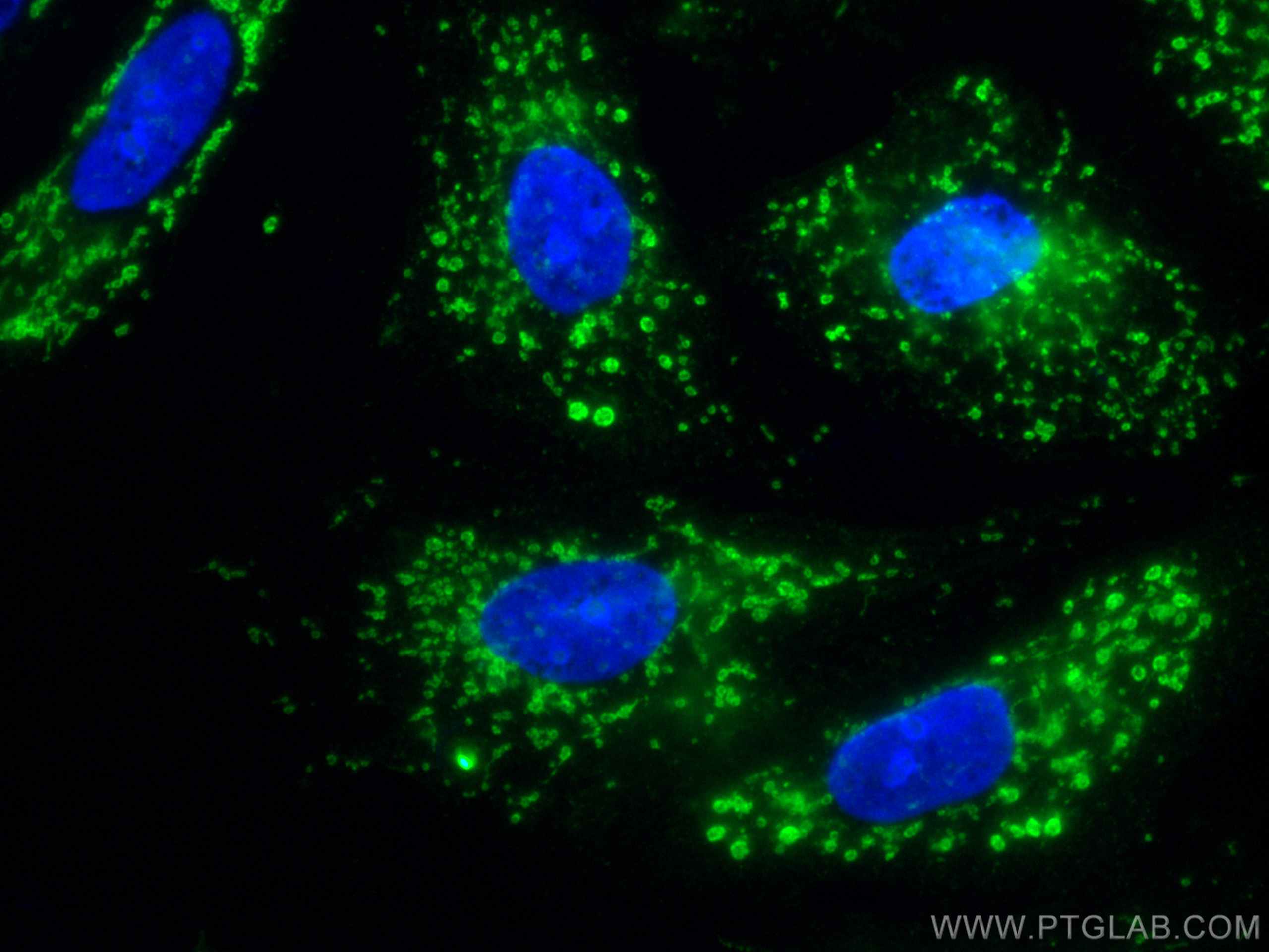 Immunofluorescence (IF) / fluorescent staining of A549 cells using CoraLite® Plus 488-conjugated FES Monoclonal antib (CL488-67524)