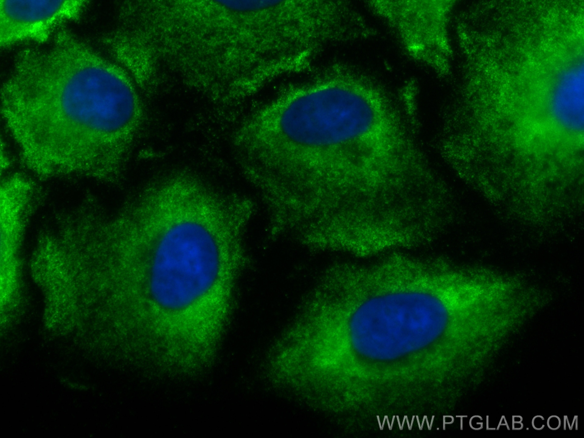 Immunofluorescence (IF) / fluorescent staining of A549 cells using CoraLite® Plus 488-conjugated FES Monoclonal antib (CL488-67524)