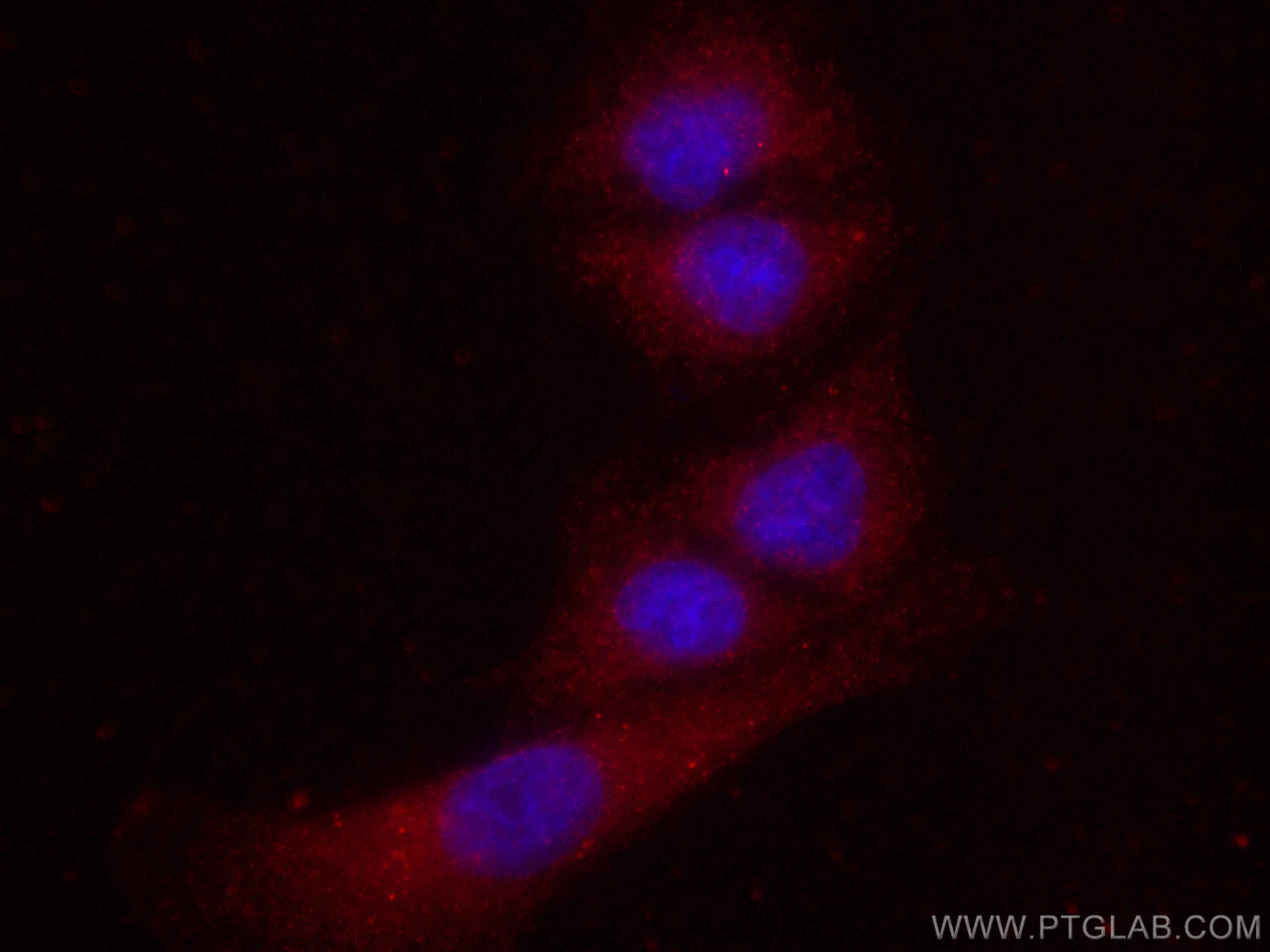 Immunofluorescence (IF) / fluorescent staining of A549 cells using CoraLite®594-conjugated FES Monoclonal antibody (CL594-67524)