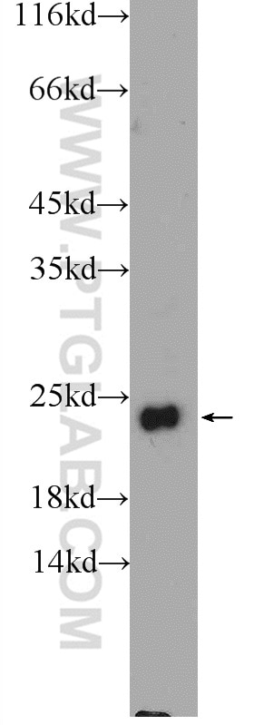 Western Blot (WB) analysis of fetal human brain tissue using FEV Polyclonal antibody (25058-1-AP)