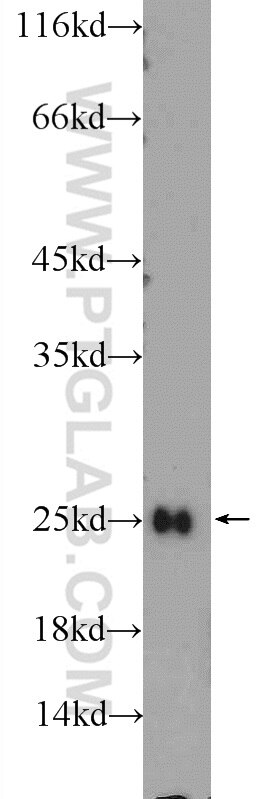 Western Blot (WB) analysis of mouse brain tissue using FEV Polyclonal antibody (25058-1-AP)