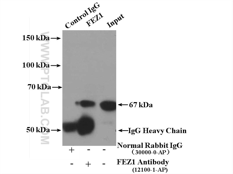 Immunoprecipitation (IP) experiment of mouse brain tissue using FEZ1 Polyclonal antibody (12100-1-AP)