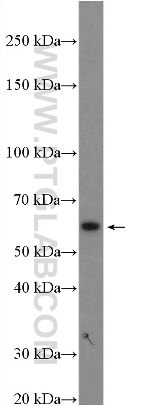 Western Blot (WB) analysis of mouse brain tissue using FEZ1 Polyclonal antibody (12100-1-AP)