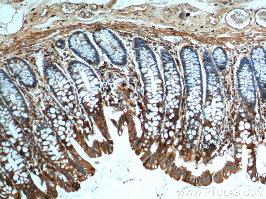 Immunohistochemistry (IHC) staining of human colon tissue using FFAR2 Polyclonal antibody (19952-1-AP)