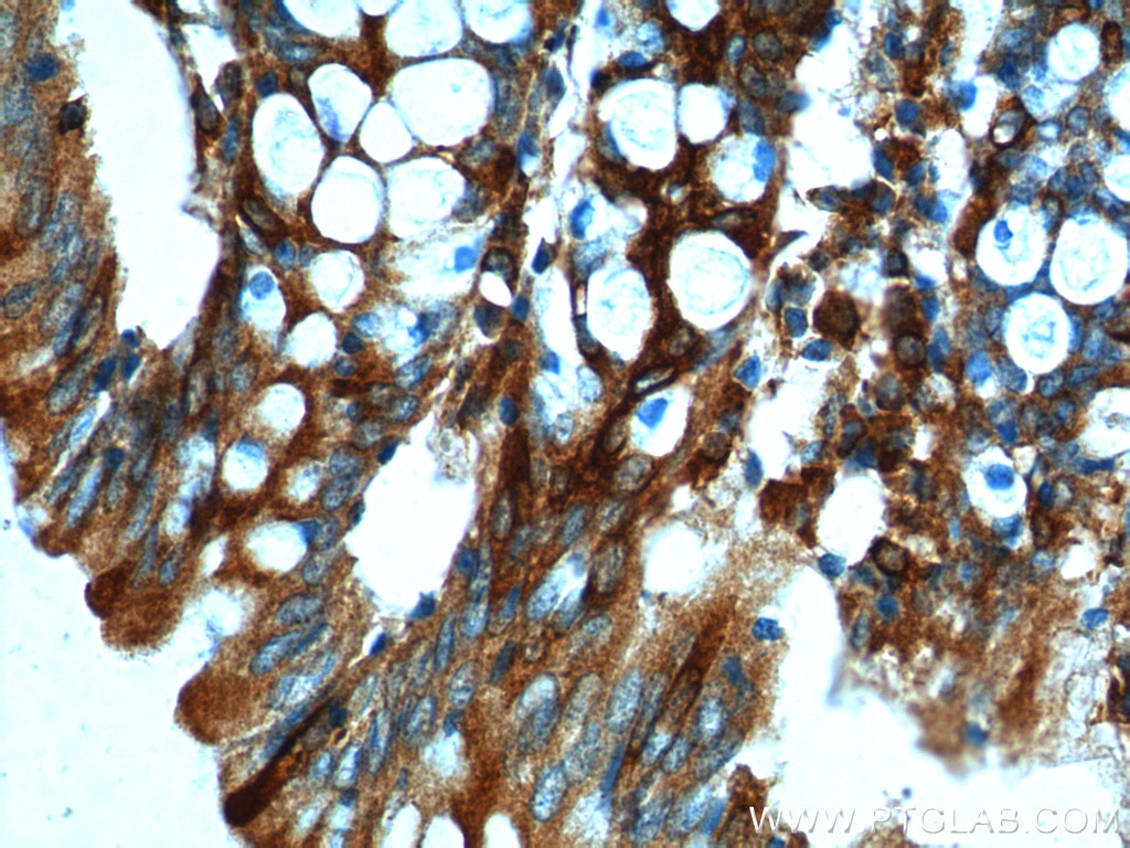 Immunohistochemistry (IHC) staining of human colon tissue using FFAR2 Polyclonal antibody (19952-1-AP)