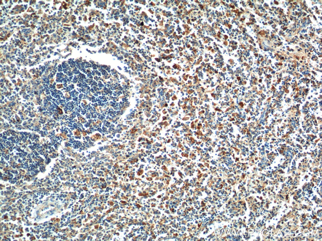 Immunohistochemistry (IHC) staining of human spleen tissue using FFAR2 Polyclonal antibody (19952-1-AP)