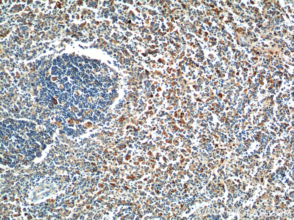 IHC staining of human spleen using 19952-1-AP