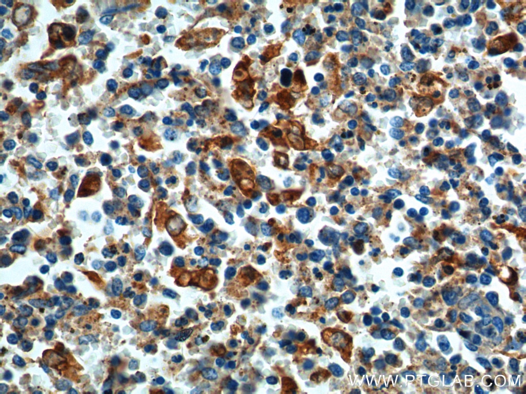 Immunohistochemistry (IHC) staining of human spleen tissue using FFAR2 Polyclonal antibody (19952-1-AP)