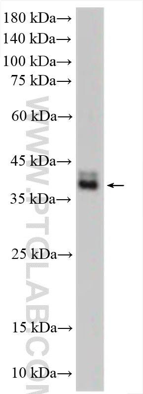 Western Blot (WB) analysis of THP-1 cells using FFAR2 Polyclonal antibody (19952-1-AP)
