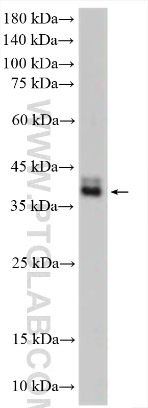 WB analysis of THP-1 using 19952-1-AP