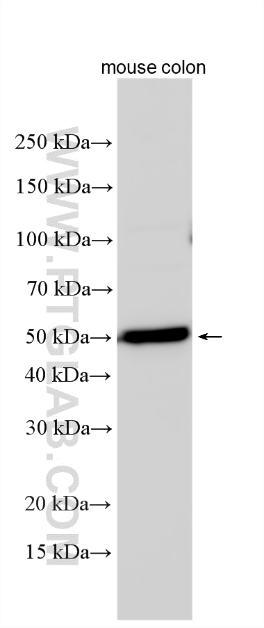 WB analysis using 21765-1-AP Western Blot (WB) analysis of various lysates using FFAR2 Polyclonal antibody (21765-1-AP)