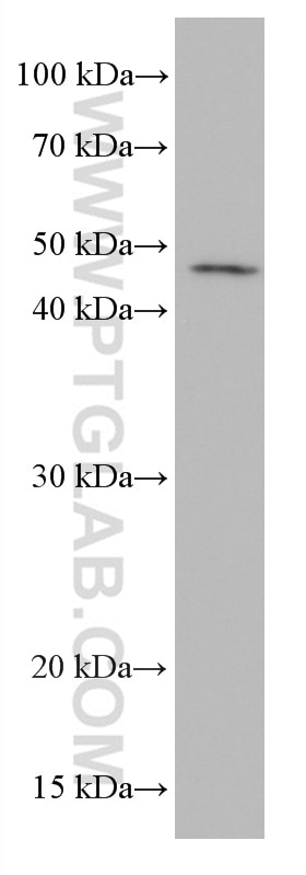 Western Blot (WB) analysis of human adipose tissue using FFAR3 Monoclonal antibody (66811-1-Ig)