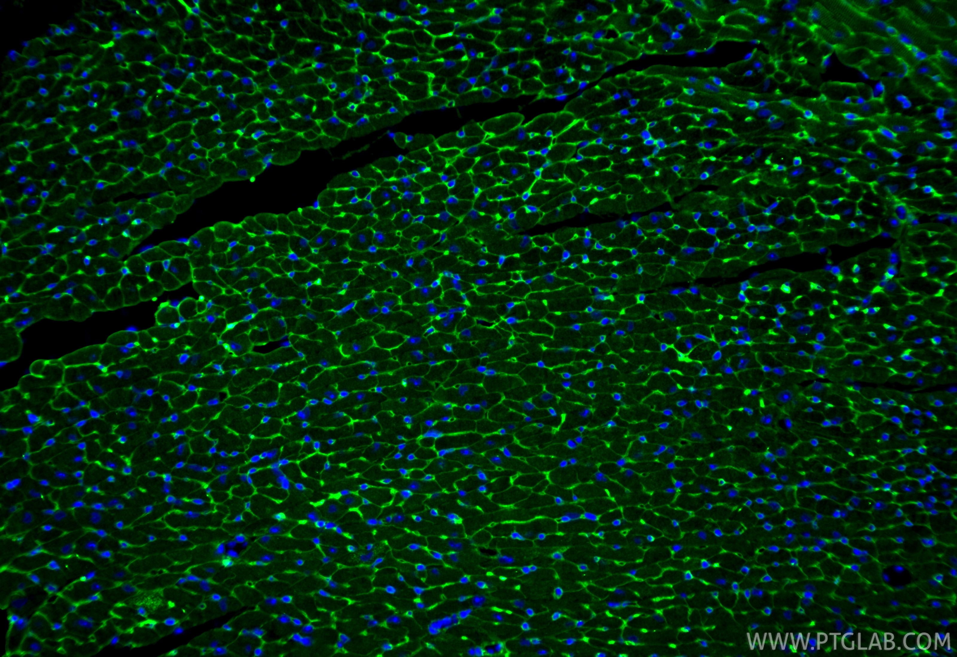 Immunofluorescence (IF) / fluorescent staining of mouse heart tissue using Fibrinogen Beta Chain Polyclonal antibody (16747-1-AP)