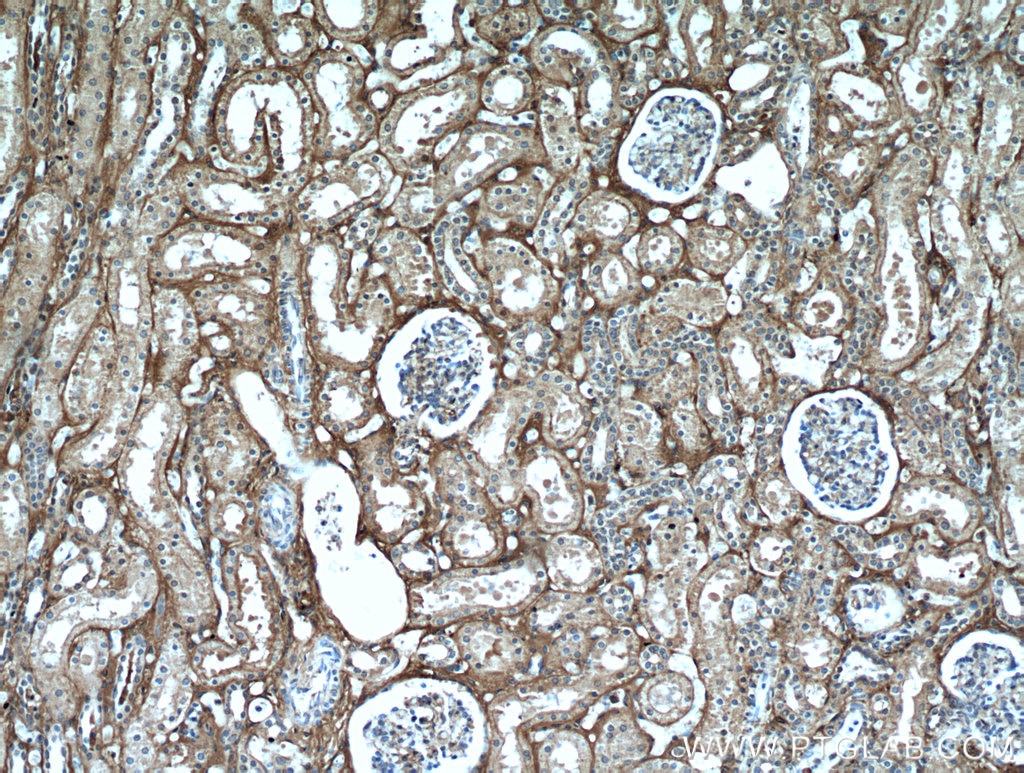 Immunohistochemistry (IHC) staining of human kidney tissue using Fibrinogen Beta Chain Polyclonal antibody (16747-1-AP)