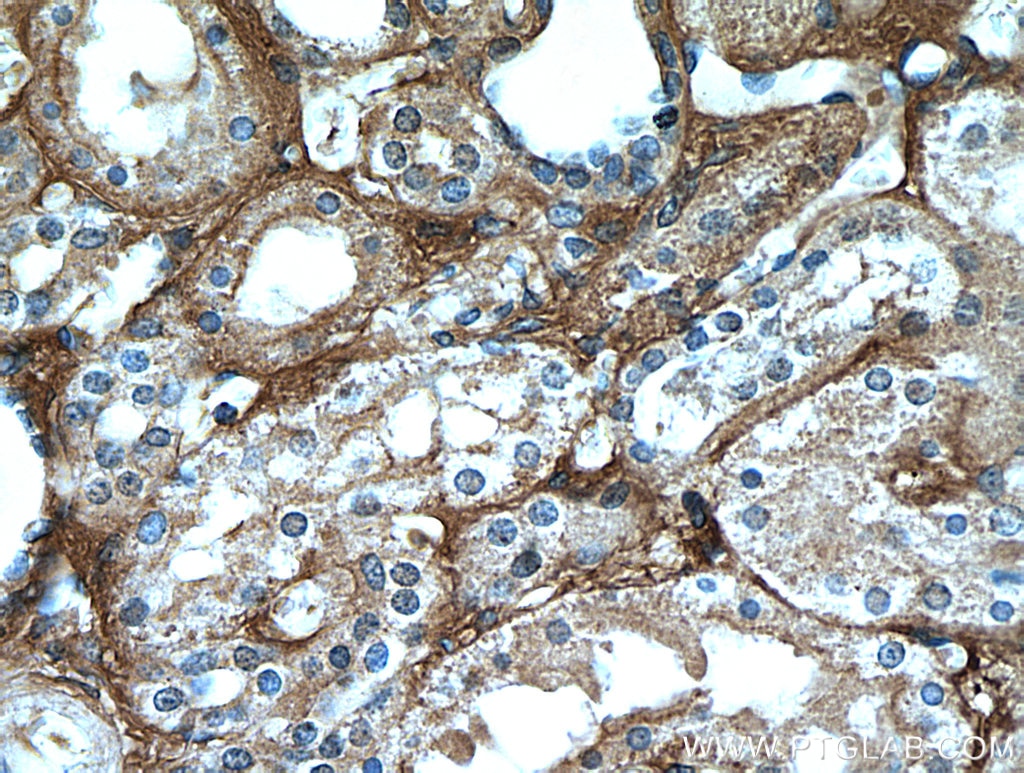 Immunohistochemistry (IHC) staining of human kidney tissue using Fibrinogen Beta Chain Polyclonal antibody (16747-1-AP)