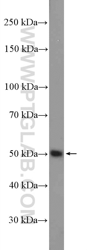 Western Blot (WB) analysis of mouse heart tissue using Fibrinogen Beta Chain Polyclonal antibody (16747-1-AP)