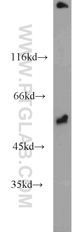 Western Blot (WB) analysis of mouse kidney tissue using Fibrinogen Beta Chain Polyclonal antibody (16747-1-AP)