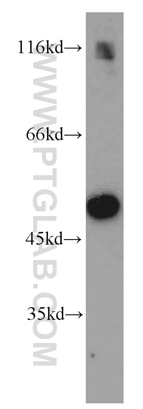 Western Blot (WB) analysis of mouse liver tissue using Fibrinogen Beta Chain Polyclonal antibody (16747-1-AP)