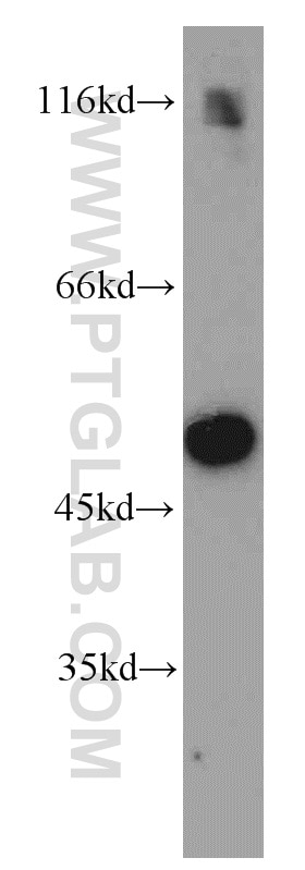 WB analysis of mouse liver using 16747-1-AP