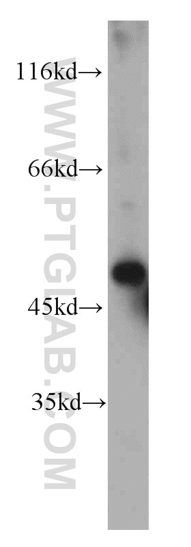 Western Blot (WB) analysis of mouse brain tissue using Fibrinogen Beta Chain Polyclonal antibody (16747-1-AP)