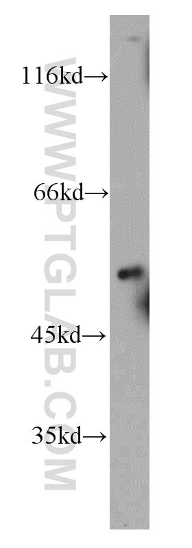 Fibrinogen Beta Chain