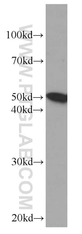 Western Blot (WB) analysis of human heart tissue using Fibrinogen Beta Chain Monoclonal antibody (66186-1-Ig)