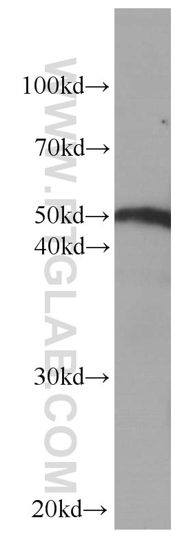 Western Blot (WB) analysis of fetal human brain tissue using Fibrinogen Beta Chain Monoclonal antibody (66186-1-Ig)
