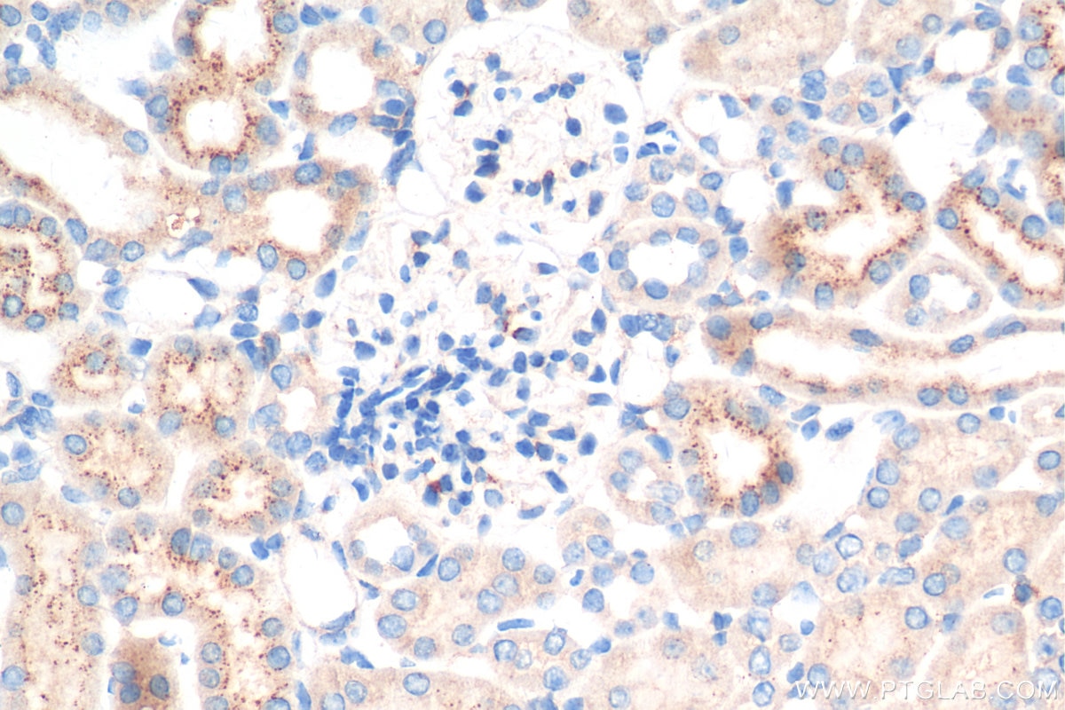 Immunohistochemistry (IHC) staining of mouse kidney tissue using FGD1 Polyclonal antibody (13141-1-AP)