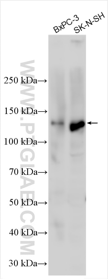 Western Blot (WB) analysis of various lysates using FGD1 Polyclonal antibody (13141-1-AP)