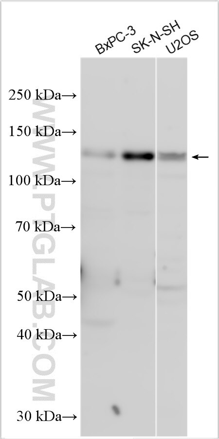 Western Blot (WB) analysis of various lysates using FGD1 Polyclonal antibody (13141-1-AP)