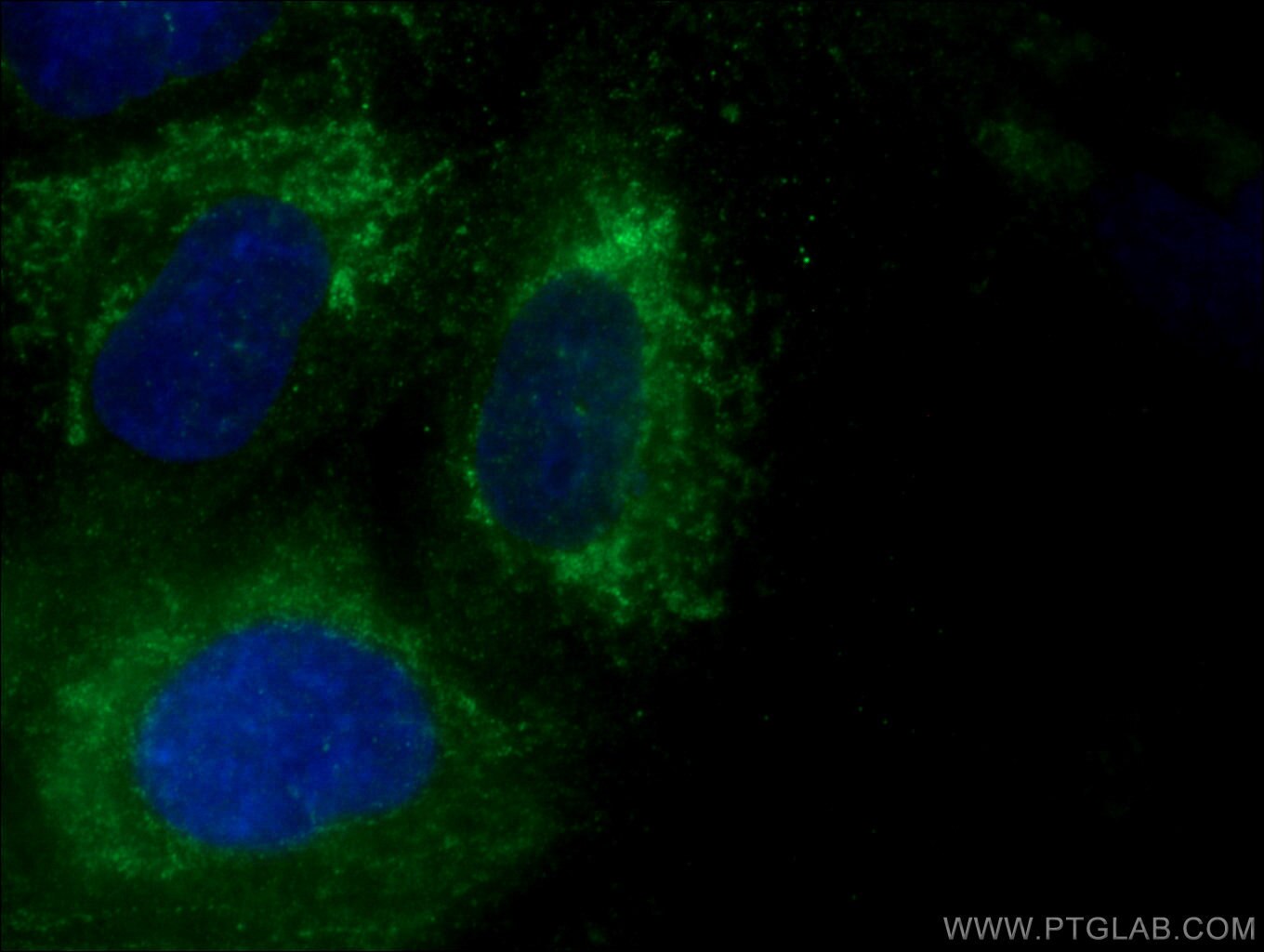 Immunofluorescence (IF) / fluorescent staining of A549 cells using FGD3 Polyclonal antibody (20347-1-AP)