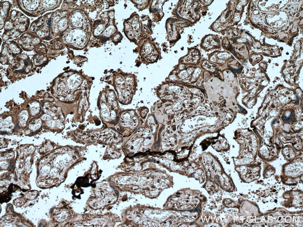 IHC staining of human placenta using 20347-1-AP