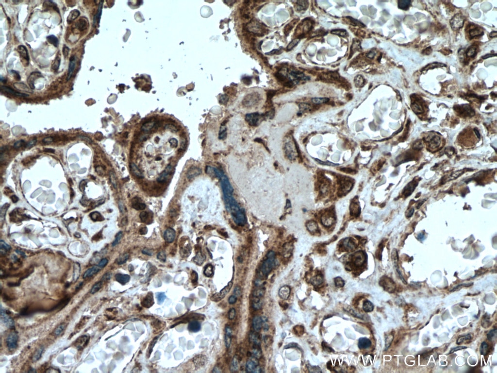 IHC staining of human placenta using 20347-1-AP